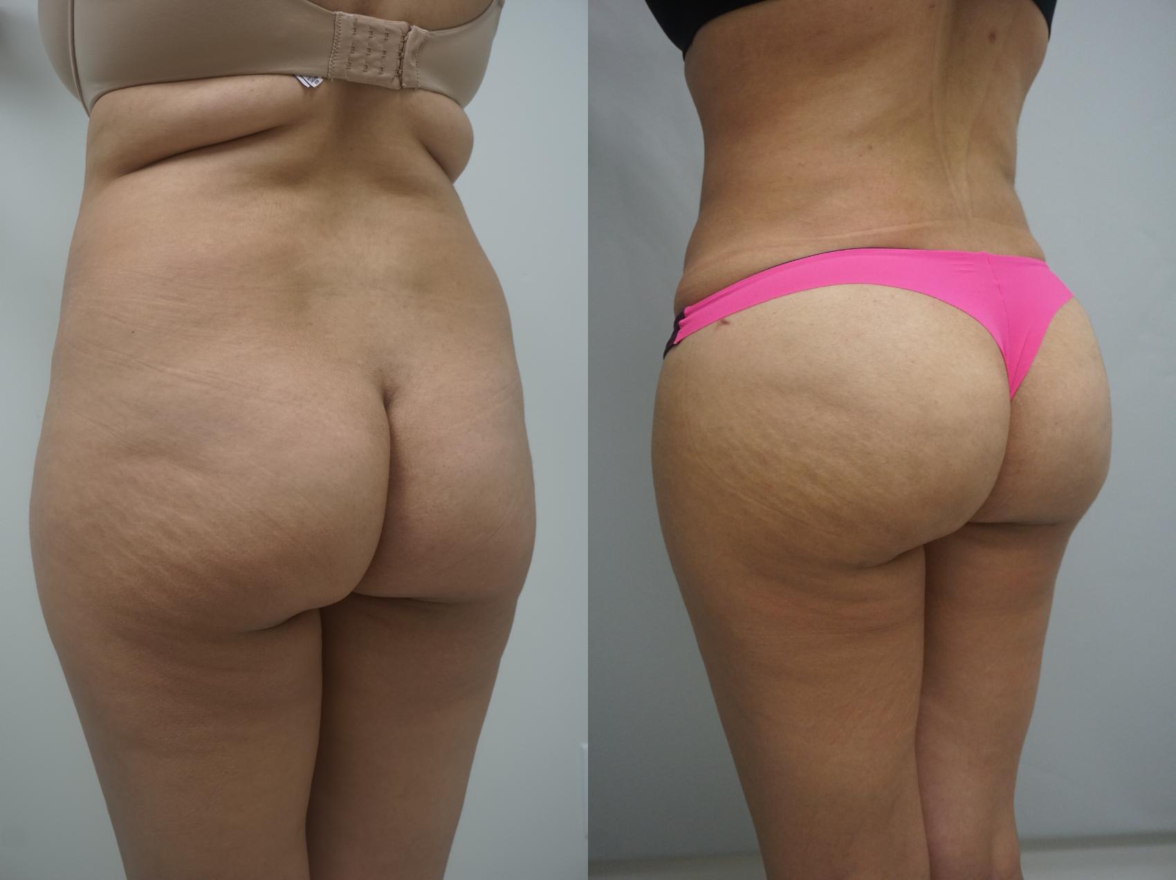 Brazil Butt Lift Workout Calendar & Before and After