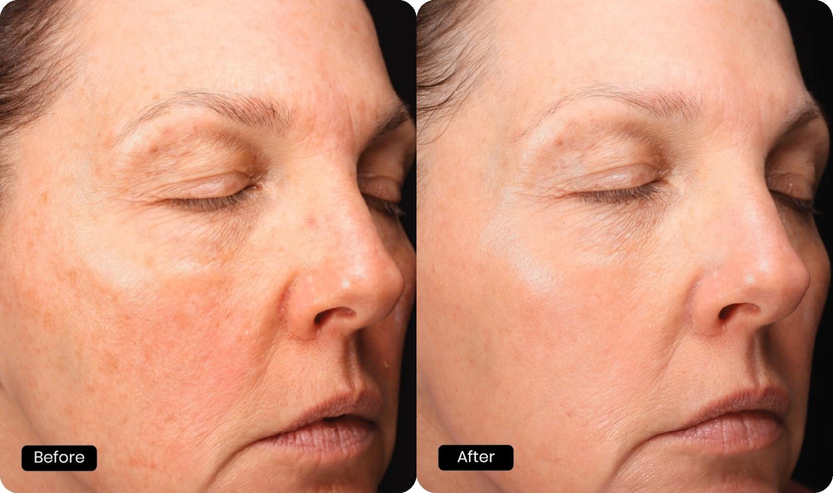 Before & After Halo Tribrid Case 509 Right Oblique View in Gilbert, AZ