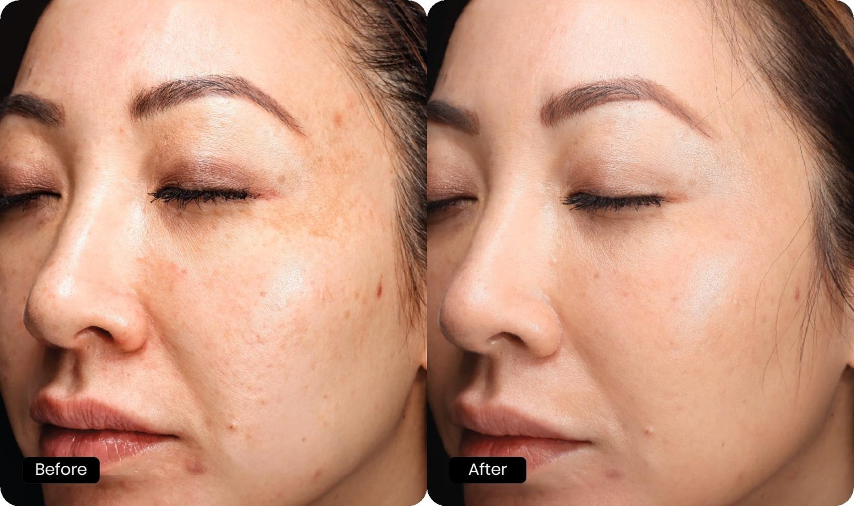 Before & After Halo Tribrid Case 510 Left Oblique View in Gilbert, AZ