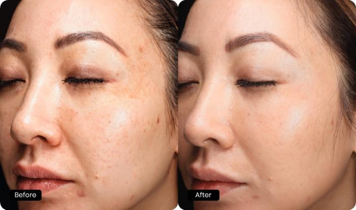 Before & After Halo Tribrid Case 510 Left Oblique View in Gilbert, AZ