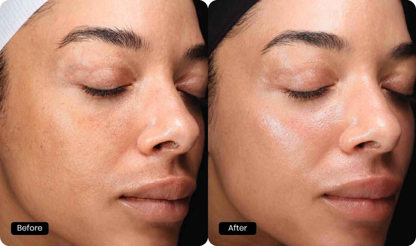 Before & After Halo Tribrid Case 511 Right Oblique View in Gilbert, AZ